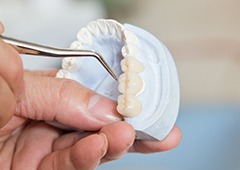Model of implant supported fixed bridge