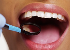 Closeup of patient receiving dental exam