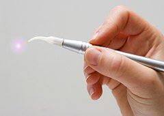 Hand holding a soft tissue laser