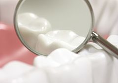 Closeup of teeth with dental sealants