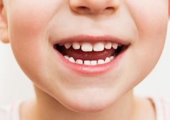 Child's healthy smile